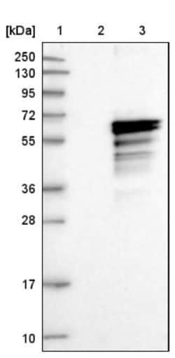 ADCK4 Antibody, Novus Biologicals 0.1mL; Unlabeled:Antibodies, Polyclonal