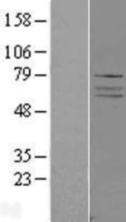 Novus Biologicals™ ADCK4 Overexpression Lysate