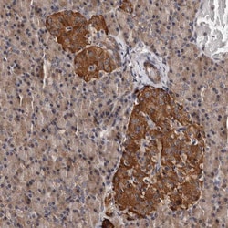 ADCK5 Antibody, Novus Biologicals:Antibodies:Primary Antibodies