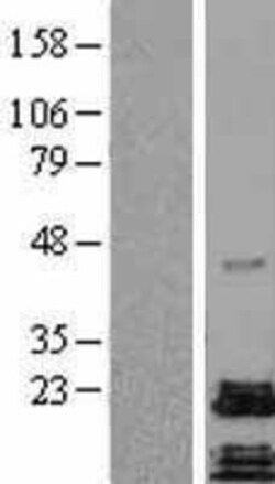 Novus Biologicals™ PACAP/ADCYAP1 Overexpression Lysate