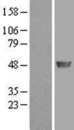 Novus Biologicals&trade;&nbsp;ADE2 Overexpression Lysate