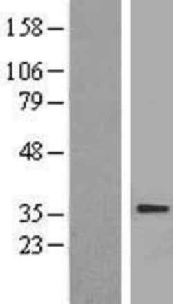 Novus Biologicals&trade;&nbsp;Adenine Nucleotide Translocase 1 Overexpression Lysate