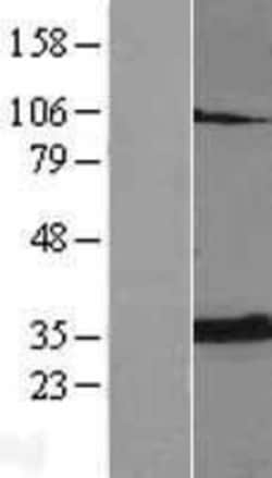 Novus Biologicals&trade;&nbsp;Adenine Nucleotide Translocator 2 Overexpression Lysate