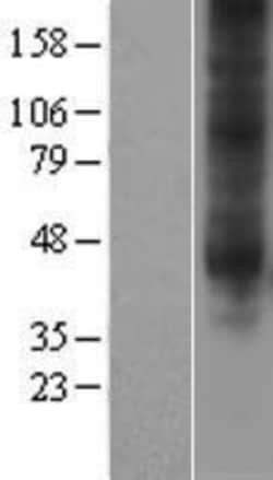 Novus Biologicals™ Adenosine A3 R Overexpression Lysate