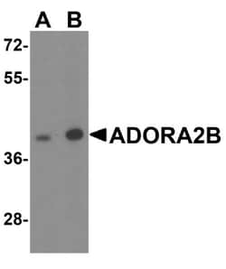 Adenosine A2b R Antibody - BSA Free, Novus Biologicals:Antibodies:Primary
