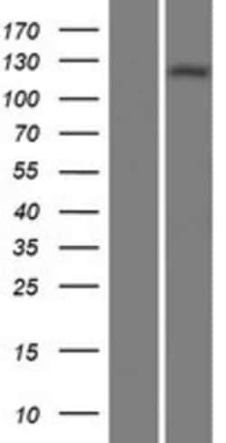 Novus Biologicals&trade;&nbsp;Adenylate Cyclase 1 Overexpression Lysate