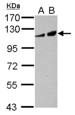 Adenylate Cyclase 2 Antibody, Novus Biologicals 0.1mL; Unlabeled:Antibodies,