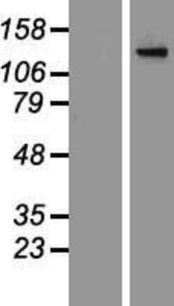 Novus Biologicals&trade;&nbsp;Adenylate Cyclase 2 Overexpression Lysate