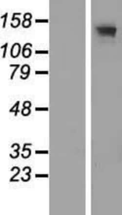 Novus Biologicals&trade;&nbsp;Adenylate Cyclase 3 Overexpression Lysate