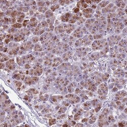 Adenylate Cyclase 7 Antibody, Novus Biologicals 25 &mu;L, Unlabeled:Antibodies,