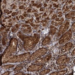 Adenylate Cyclase 2 Antibody, Novus Biologicals:Antibodies:Primary Antibodies