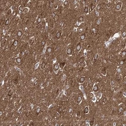 Adenylate Cyclase 2 Antibody, Novus Biologicals:Antibodies:Primary Antibodies
