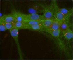 Adenylate Cyclase 3 Antibody, Novus Biologicals 0.025mL; Unlabeled:Antibodies,