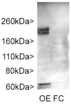 Adenylate Cyclase 3 Antibody, Novus Biologicals 0.025mL; Unlabeled:Antibodies,