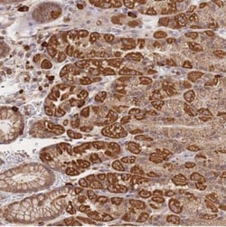 Adenylate Cyclase 9 Antibody, Novus Biologicals:Antibodies:Primary Antibodies