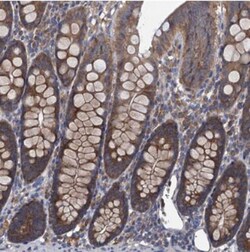 Adenylate Cyclase 9 Antibody, Novus Biologicals:Antibodies:Primary Antibodies