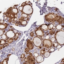 Adenylate Kinase 1 Antibody, Novus Biologicals 0.1mL; Unlabeled:Antibodies,