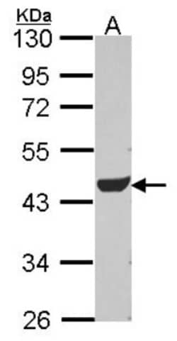 Adenylosuccinate Lyase Antibody, Novus Biologicals 0.1mL; Unlabeled:Antibodies,
