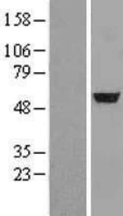 Novus Biologicals™ Adenylosuccinate Lyase Overexpression Lysate