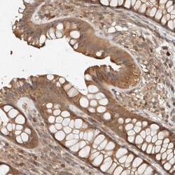 Adenylosuccinate Synthase Antibody, Novus Biologicals:Antibodies:Primary
