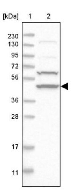 Adenylosuccinate Synthase Antibody, Novus Biologicals:Antibodies:Primary