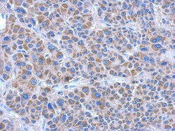 ADHFE1 Antibody, Novus Biologicals 0.1 mL | Buy Online | Novus Biologicals | Fisher Scientific