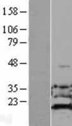 Novus Biologicals™ ADI1 Overexpression Lysate