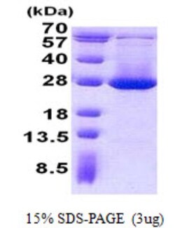 Novus Biologicals&trade;&nbsp;Recombinant Human ADI1 His Protein