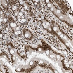 ADI1 Antibody, Novus Biologicals:Antibodies:Primary Antibodies