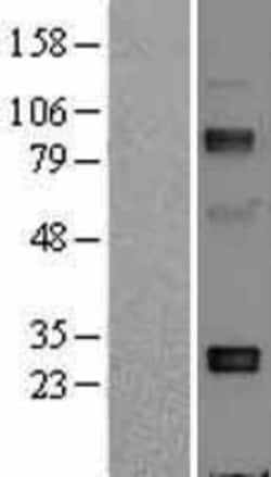 Novus Biologicals&trade;&nbsp;Adiponectin/Acrp30 Overexpression Lysate