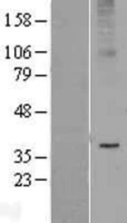 Novus Biologicals™ AdipoR2 Overexpression Lysate