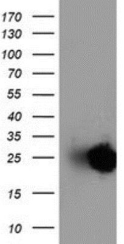 Adiponectin/Acrp30 Antibody (OTI1H1), Novus Biologicals 0.1mL; Unlabeled:Antibodies,