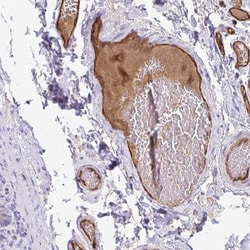 Adiponectin/Acrp30 Antibody, Novus Biologicals 0.1mL; Unlabeled:Antibodies,