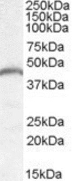 Adiponutrin/PNPLA3 Antibody, Novus Biologicals 0.1mg; Unlabeled:Antibodies,