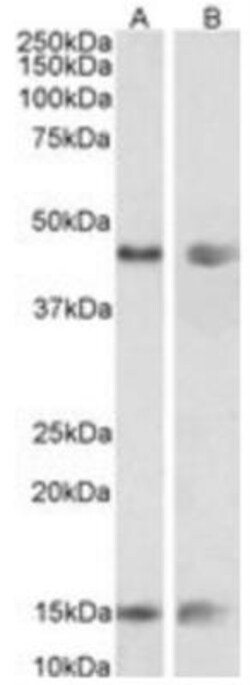 Adiponutrin/PNPLA3 Antibody, Novus Biologicals 0.1mg; Unlabeled:Antibodies,