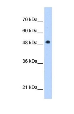 Adiponutrin/PNPLA3 Antibody, Novus Biologicals 100 &mu;L | Buy Online | Novus Biologicals | Fisher Scientific