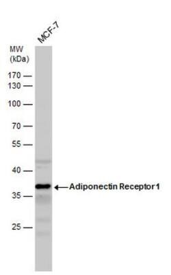 AdipoR1 Antibody, Novus Biologicals 0.1mL; Unlabeled:Antibodies, Polyclonal