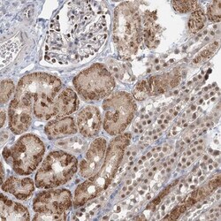 ADK Antibody, Novus Biologicals 25 &mu;L, Unlabeled:Antibodies, Polyclonal