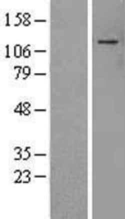 Novus Biologicals&trade;&nbsp;ADNP Overexpression Lysate