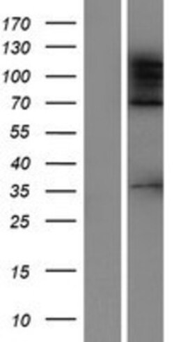 Novus Biologicals™ ADNP2 Overexpression Lysate