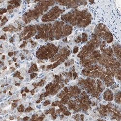 ADNP2 Antibody, Novus Biologicals:Antibodies:Primary Antibodies