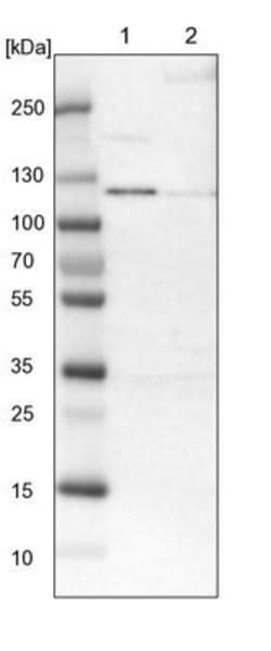 ADNP2 Antibody, Novus Biologicals:Antibodies:Primary Antibodies