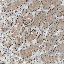 ADNP Antibody, Novus Biologicals 25 &mu;L; Unlabeled:Antibodies, Polyclonal