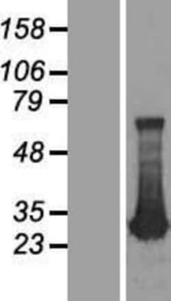 Novus Biologicals™ ADO Overexpression Lysate