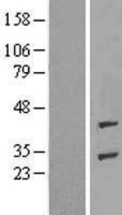 Novus Biologicals&trade;&nbsp;ADPRHL1 Overexpression Lysate