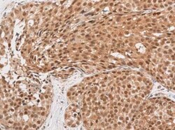 ADPRHL2 Antibody, Novus Biologicals 0.1mL; Unlabeled:Antibodies, Polyclonal