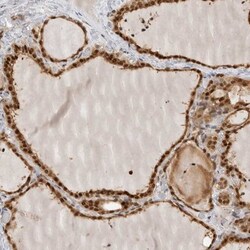 ADPRHL2 Antibody, Novus Biologicals 0.1mL; Unlabeled:Antibodies, Polyclonal