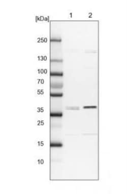 ADPRHL2 Antibody, Novus Biologicals 0.1mL; Unlabeled:Antibodies, Polyclonal