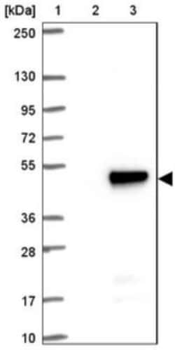 ADPRM Antibody, Novus Biologicals 0.1mL; Unlabeled:Antibodies, Polyclonal