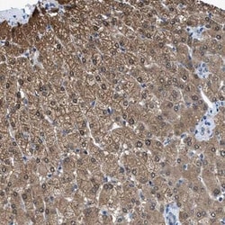 ADP-Sugar Pyrophosphatase/NUDT5 Antibody, Novus Biologicals 0.1mL; Unlabeled:Antibodies,